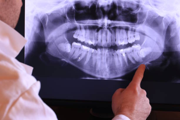 Best Emergency Root Canal Treatment in Volo, IL